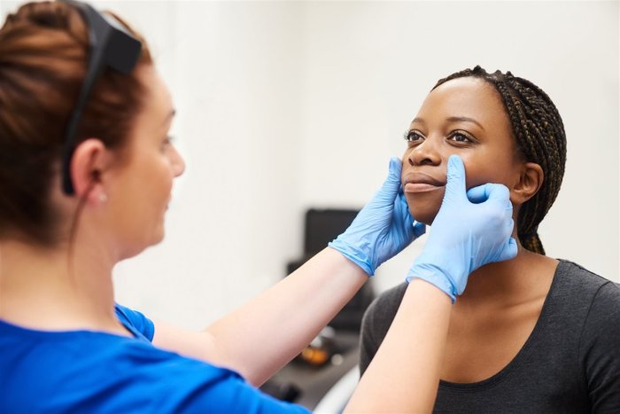 Acne dermatology